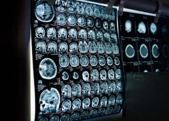 hidden brain circuit