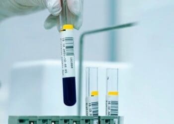 Topsoe Expands Engineering Pipeline