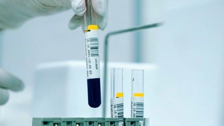 Topsoe expands engineering pipeline focused on ammonia production from clean hydrogen 1 Topsoe Expands Engineering Pipeline