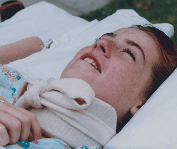 Stacey Copas shown in the hospital after her childhood diving accident.